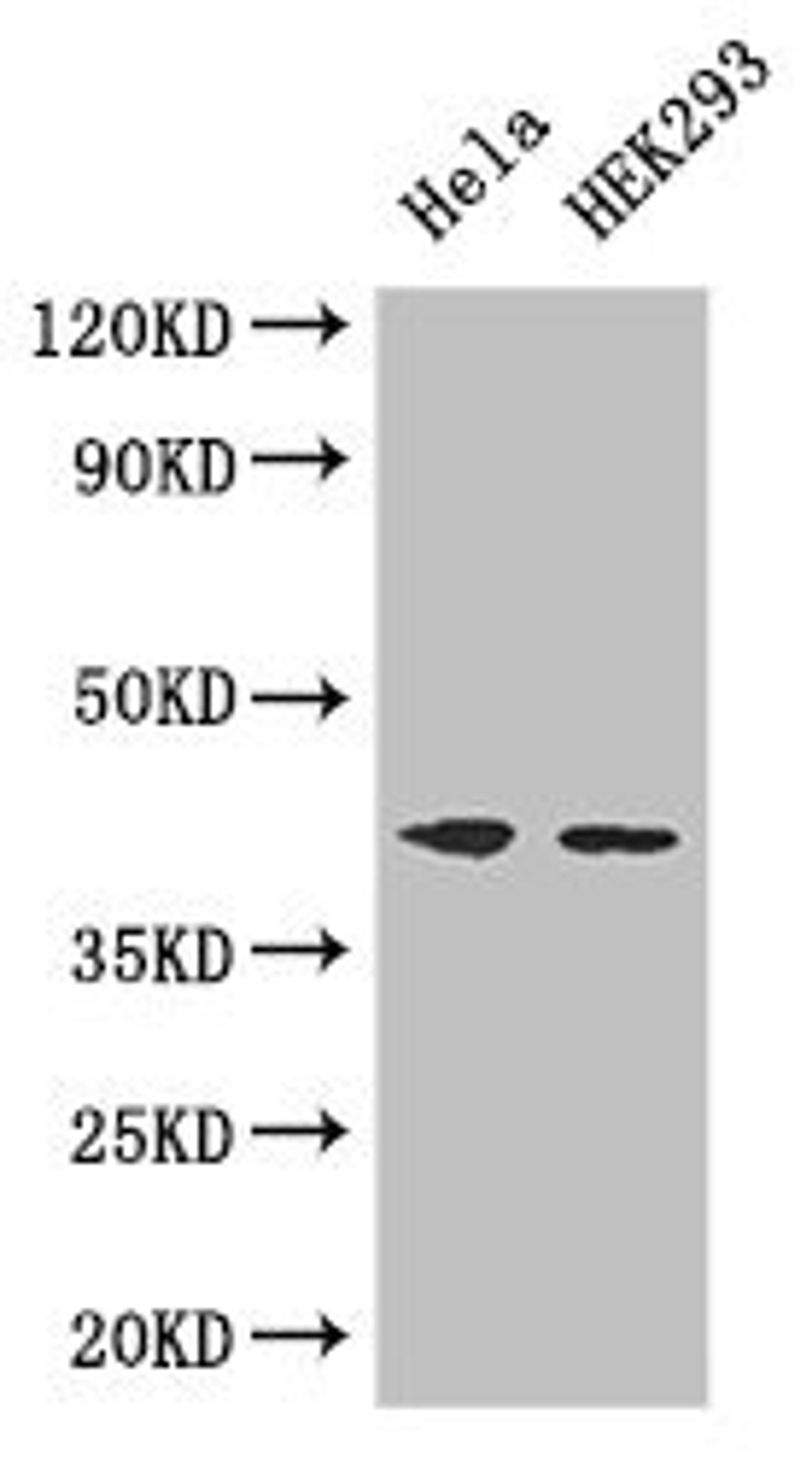 Western Blot. Positive WB detected in: Hela whole cell lysate, HEK293 whole cell lysate. All lanes: ACTG1 antibody at 3ug/ml. Secondary. Goat polyclonal to rabbit IgG at 1/50000 dilution. Predicted band size: 42 kDa. Observed band size: 42 kDa. 