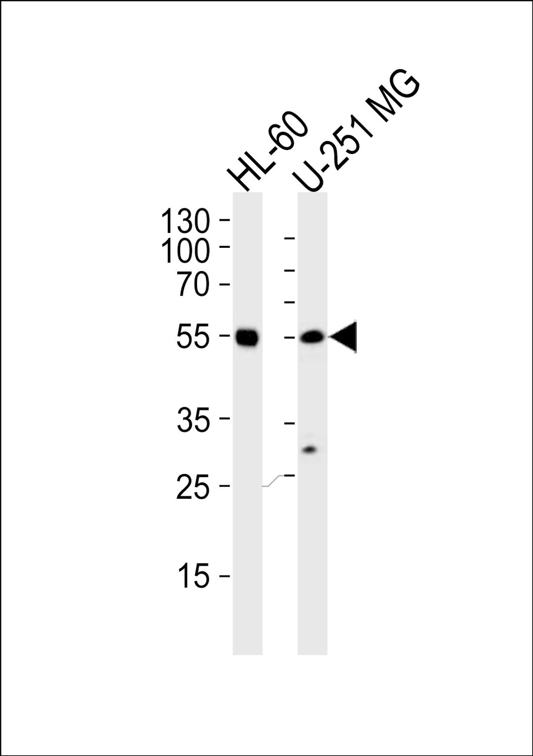 Western blot analysis of lysates from HL-60, U251 MG cell line (from left to right), using RELA Antibody at 1:1000 at each lane.