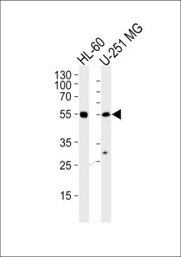 Western blot analysis of lysates from HL-60, U251 MG cell line (from left to right), using RELA Antibody at 1:1000 at each lane.