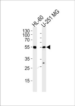 Western blot analysis of lysates from HL-60, U251 MG cell line (from left to right), using RELA Antibody at 1:1000 at each lane.