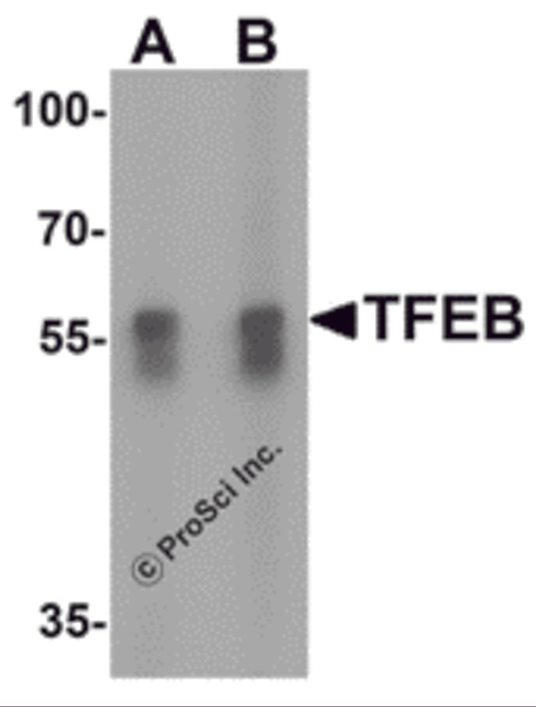 Western blot analysis of TFEB in A549 cell lysate with TFEB antibody at (A) 1 and (B) 2 μg/mL.