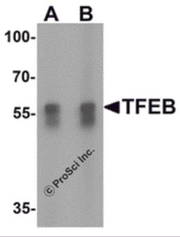 Western blot analysis of TFEB in A549 cell lysate with TFEB antibody at (A) 1 and (B) 2 μg/mL.