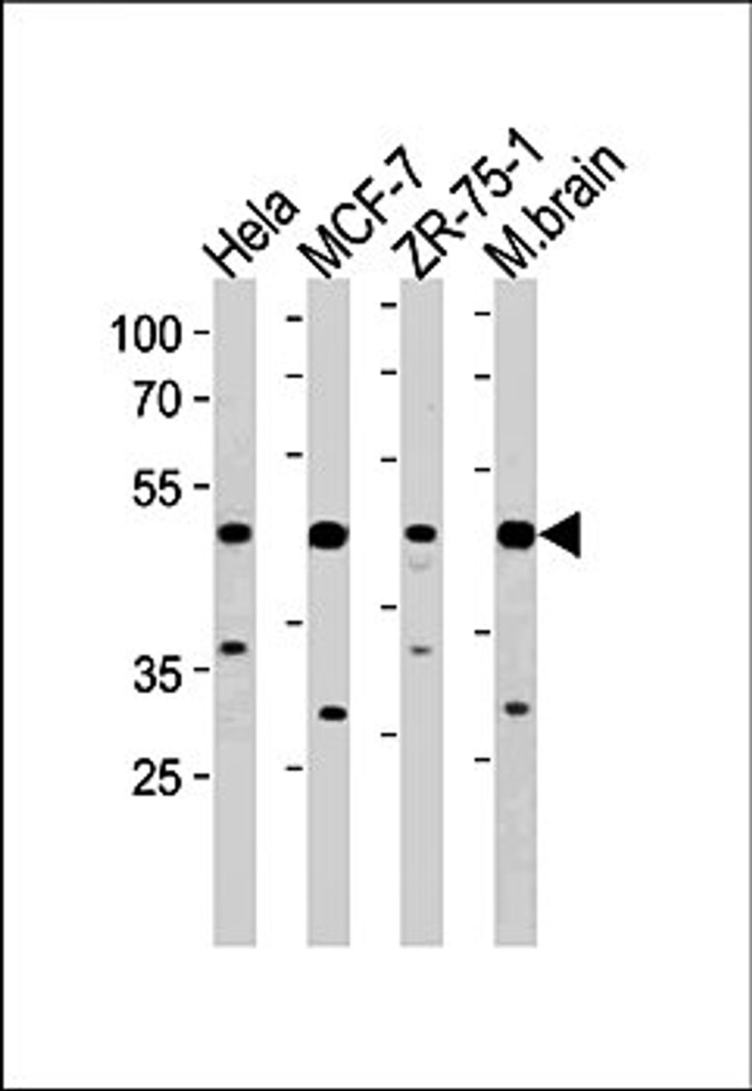 Western blot analysis of Hela, MCF-7, ZR-75-1 cell line and mouse brain lysates (35ug/lane) using FBXO28 antibody (C-term)