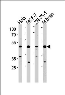 Western blot analysis of Hela, MCF-7, ZR-75-1 cell line and mouse brain lysates (35ug/lane) using FBXO28 antibody (C-term)