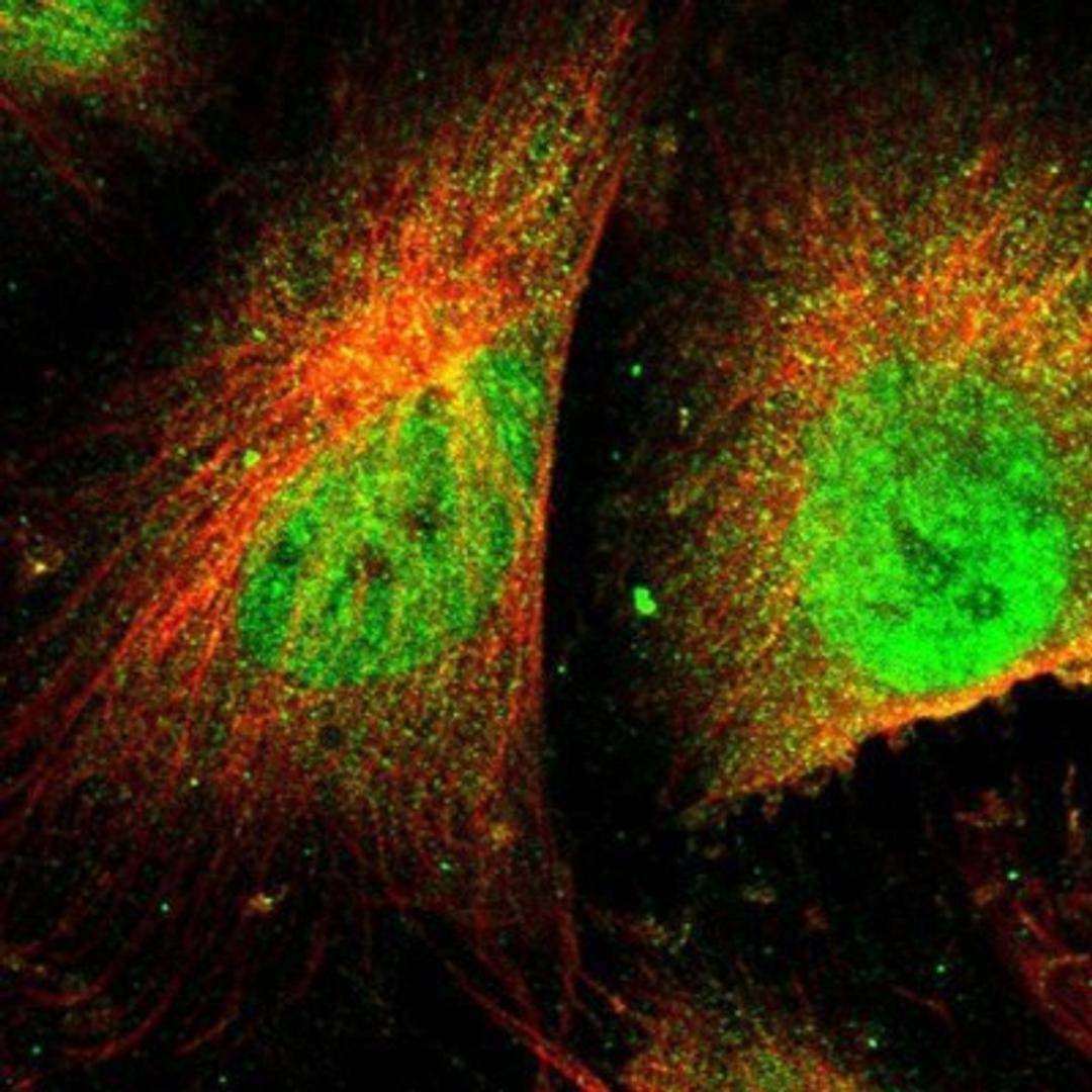 Immunocytochemistry/Immunofluorescence: ASPP1 Antibody [NBP1-90078] - Staining of human cell line U-251MG shows positivity in nucleus but not nucleoli & cytoplasm.