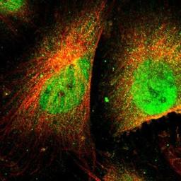 Immunocytochemistry/Immunofluorescence: ASPP1 Antibody [NBP1-90078] - Staining of human cell line U-251MG shows positivity in nucleus but not nucleoli & cytoplasm.