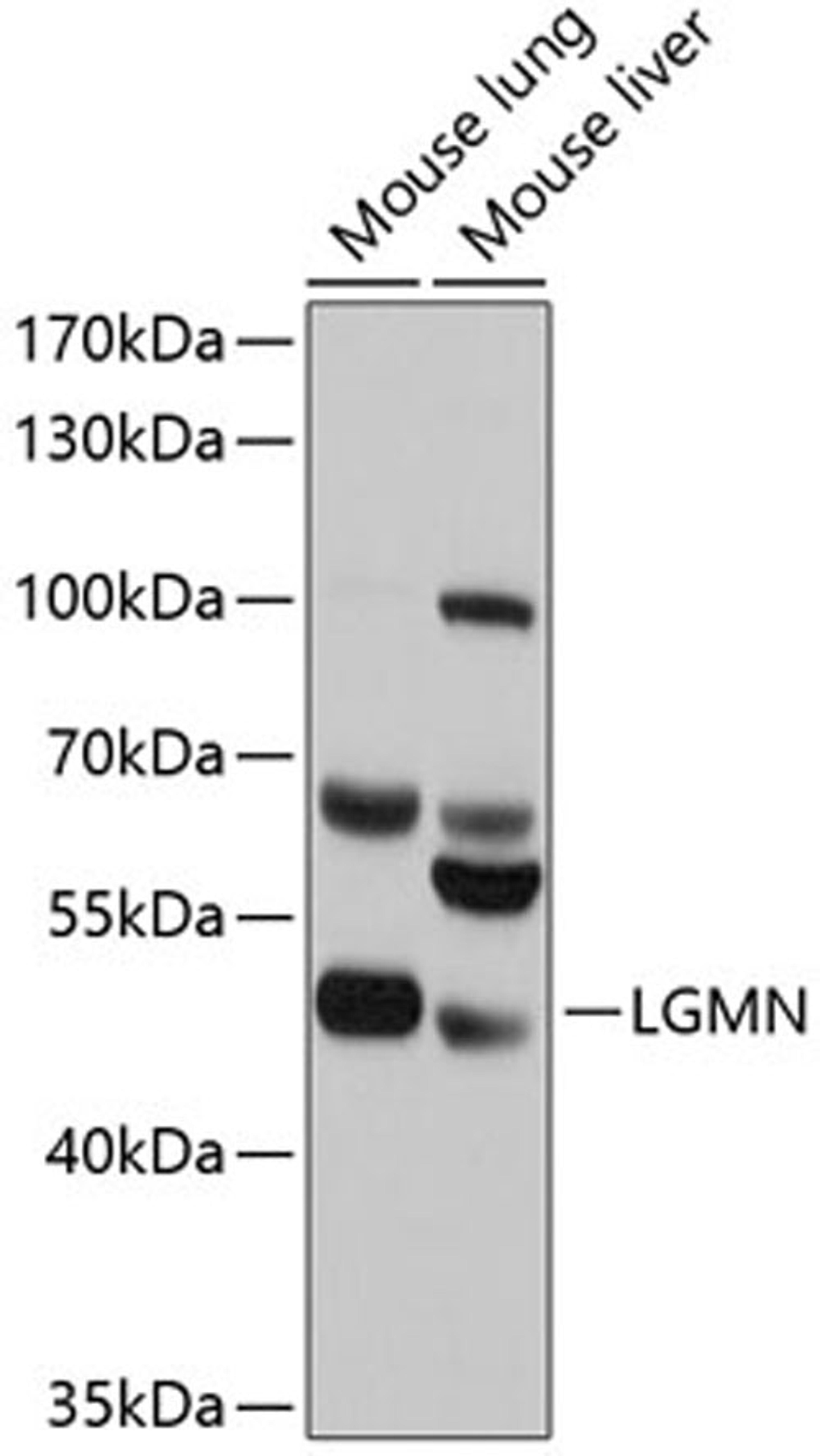 Western blot - LGMN antibody (A10570)