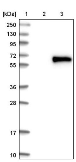 Western Blot: Ajuba Antibody [NBP1-89570] - Lane 1: Marker [kDa] 250, 130, 95, 72, 55, 36, 28, 17, 10<br/>Lane 2: Negative control (vector only transfected HEK293T lysate)<br/>Lane 3: Over-expression lysate (Co-expressed with a C-terminal myc-DDK tag (~3.1 kDa) in mammalian HEK293T cells, LY409908)