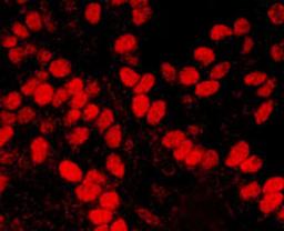 Detection of human HMGN1 by immunohistochemistry.