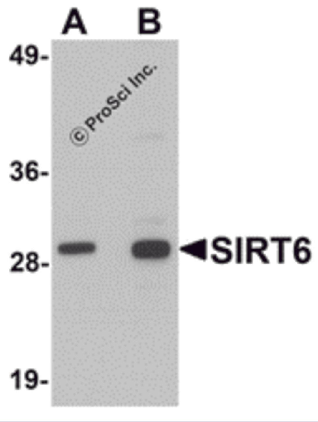Western blot analysis of SIRT6 in HeLa cell lysate with SIRT6 antibody at (A) 0.5 and (B) 1 μg/mL.