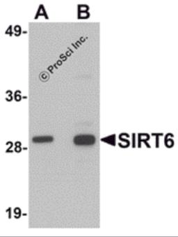 Western blot analysis of SIRT6 in HeLa cell lysate with SIRT6 antibody at (A) 0.5 and (B) 1 μg/mL.