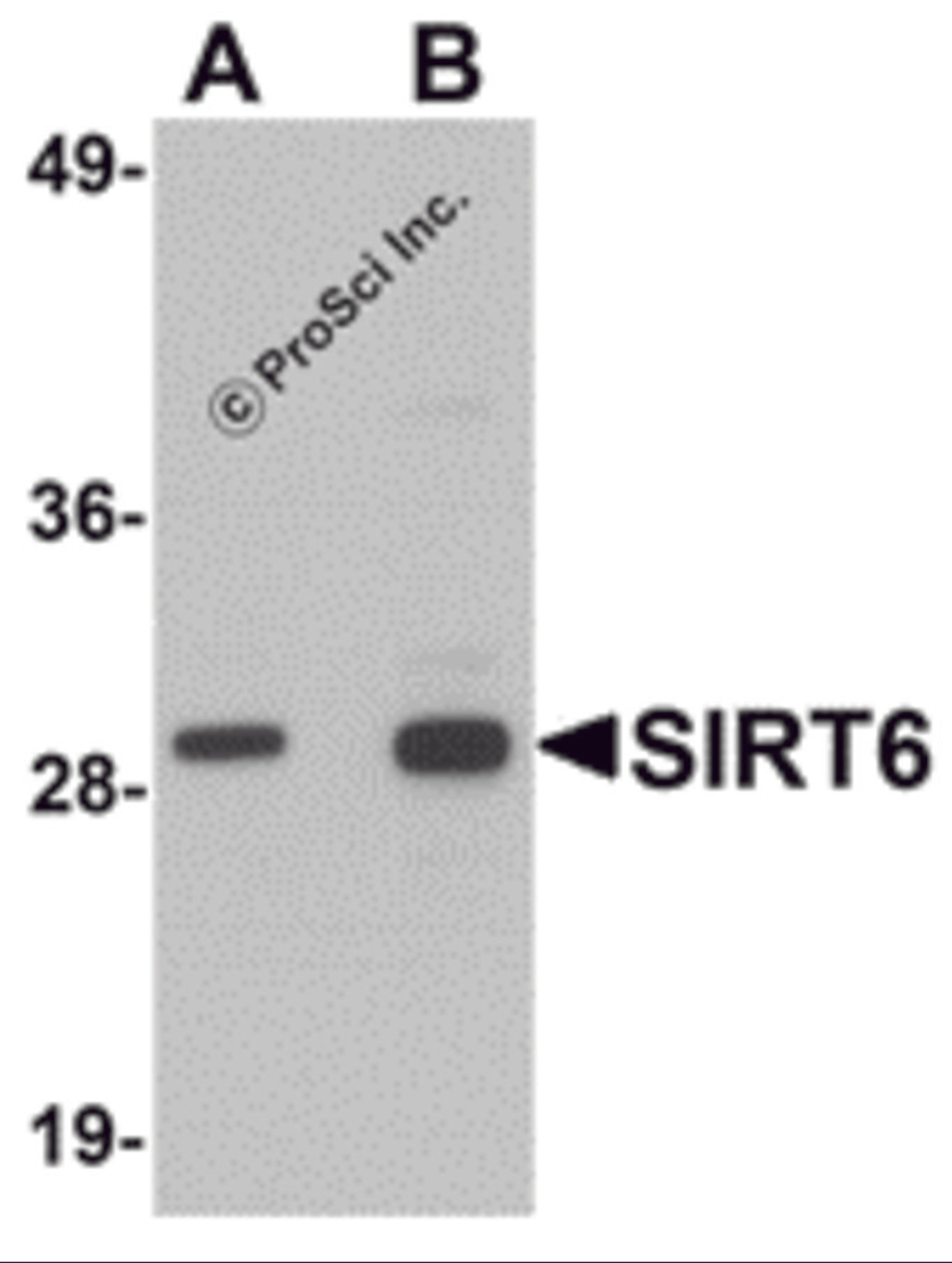 Western blot analysis of SIRT6 in HeLa cell lysate with SIRT6 antibody at (A) 0.5 and (B) 1 μg/mL.
