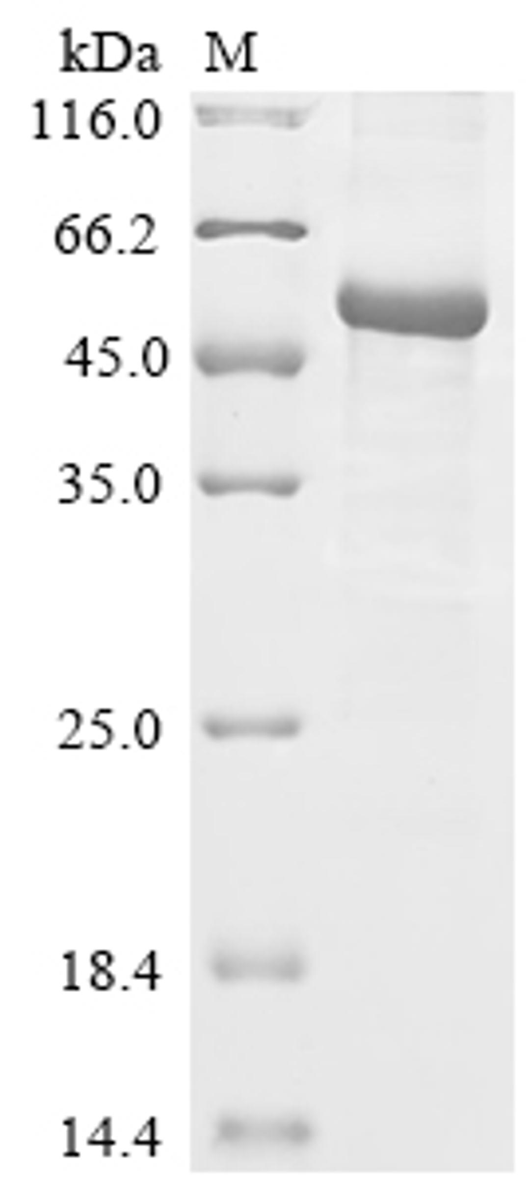 (Tris-Glycine gel) Discontinuous SDS-PAGE (reduced) with 5% enrichment gel and 15% separation gel.