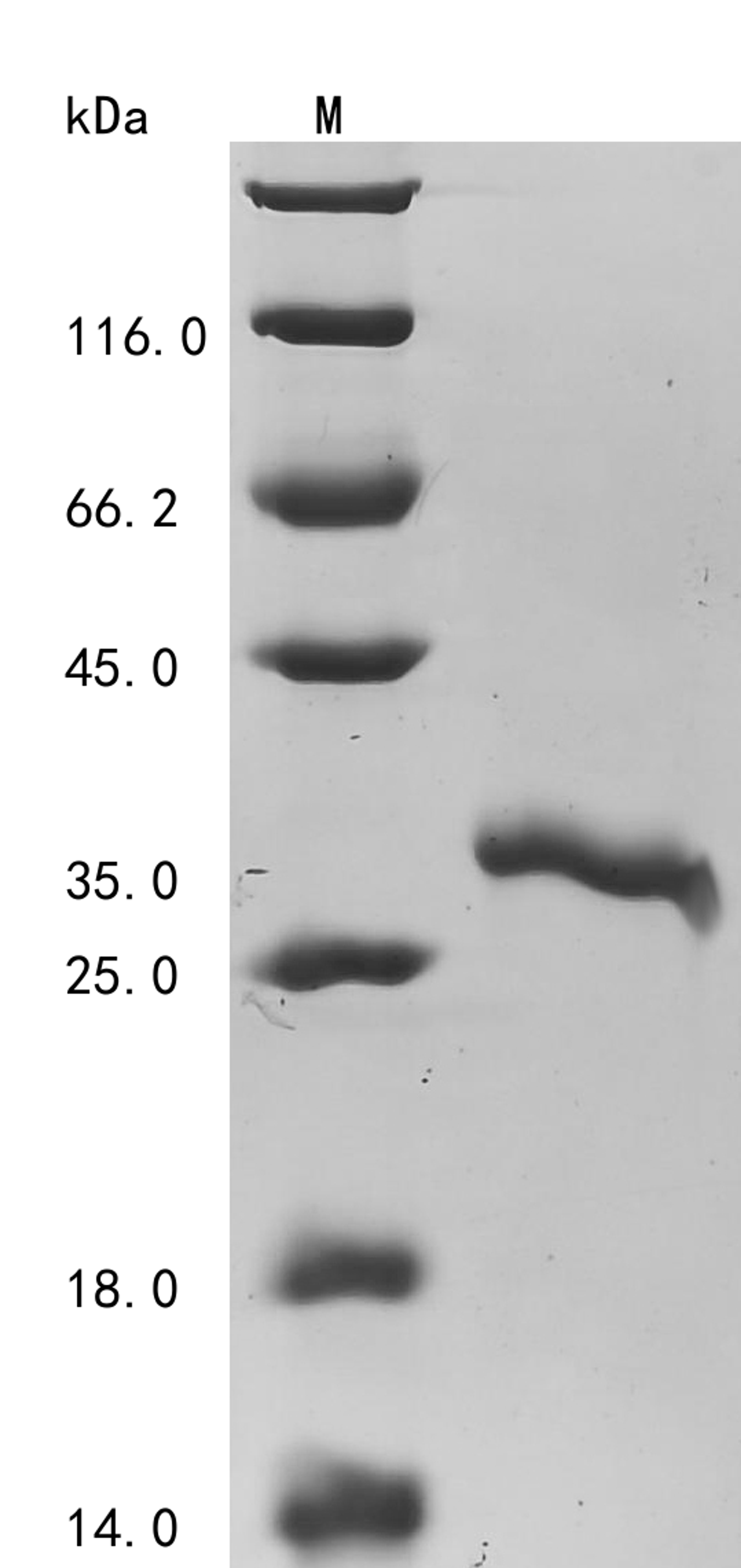 (Tris-Glycine gel) Discontinuous SDS-PAGE (reduced) with 5% enrichment gel and 15% separation gel.