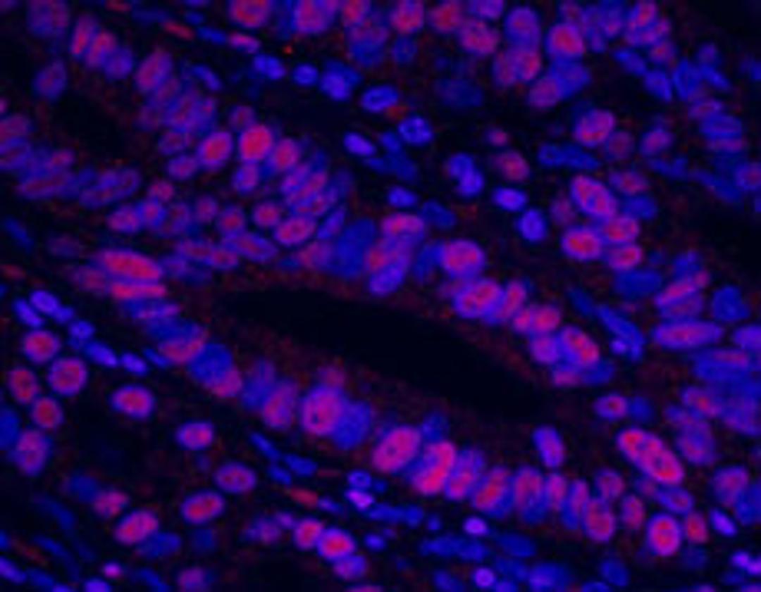 Detection of human MCM3 by immunofluorescence.