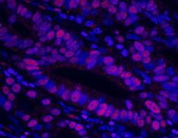 Detection of human MCM3 by immunofluorescence.