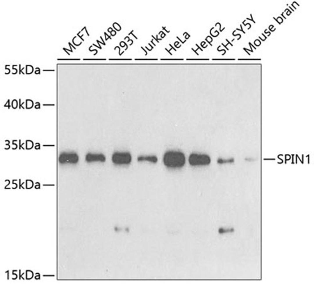 Western blot - SPIN1 antibody (A5853)