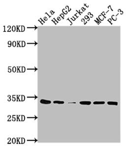 Western Blot. Positive WB detected in: Hela whole cell lysate, HepG2 whole cell lysate, Jurkat whole cell lysate, 293 whole cell lysate, MCF-7 whole cell lysate, PC-3 whole cell lysate. All lanes: CDK4 antibody at 1:2000. Secondary. Goat polyclonal to rabbit IgG at 1/50000 dilution. Predicted band size: 34, 21 kDa. Observed band size: 34 kDa. 