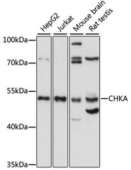 Western blot - CHKA antibody (A15040)