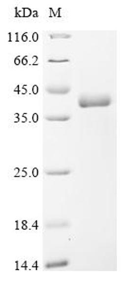 (Tris-Glycine gel) Discontinuous SDS-PAGE (reduced) with 5% enrichment gel and 15% separation gel.
