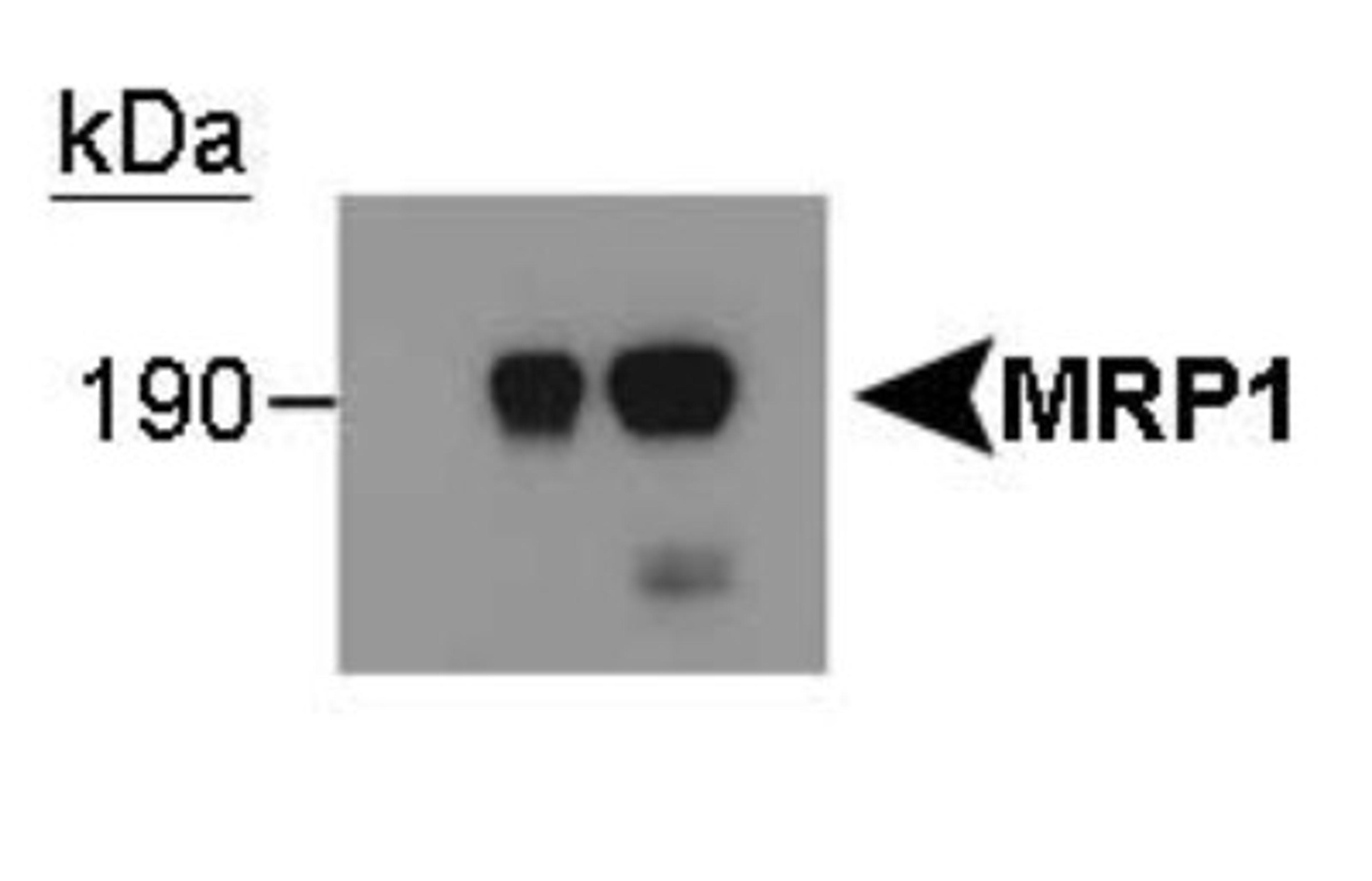 Western Blot: MRP1 Antibody (IU2H10) [NB400-156] - Vector-transfected HEK293 cells 2: MRP1-transfected cells, prep1 3: MRP1-transfected cells, prep2 (the lower band is a degradation product.