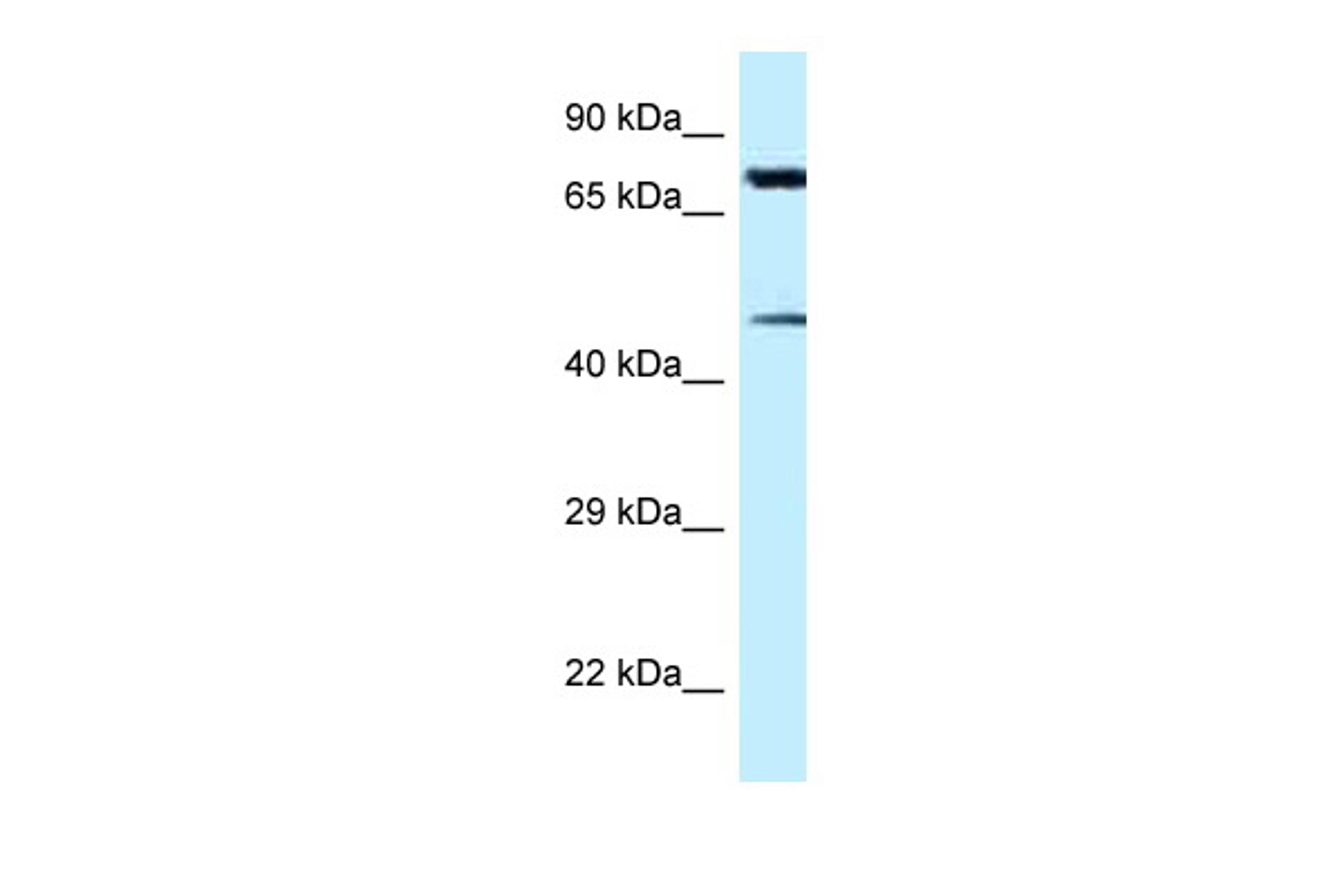 Antibody used in WB on Human HepG2 at 5.0 ug/ml.