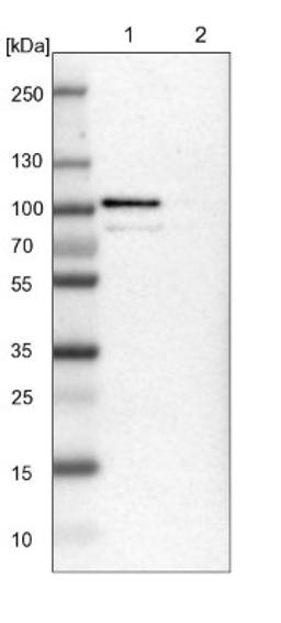 Western Blot: TTC14 Antibody [NBP1-84657] - Lane 1: NIH-3T3 cell lysate (Mouse embryonic fibroblast cells)<br/>Lane 2: NBT-II cell lysate (Rat Wistar bladder tumour cells)