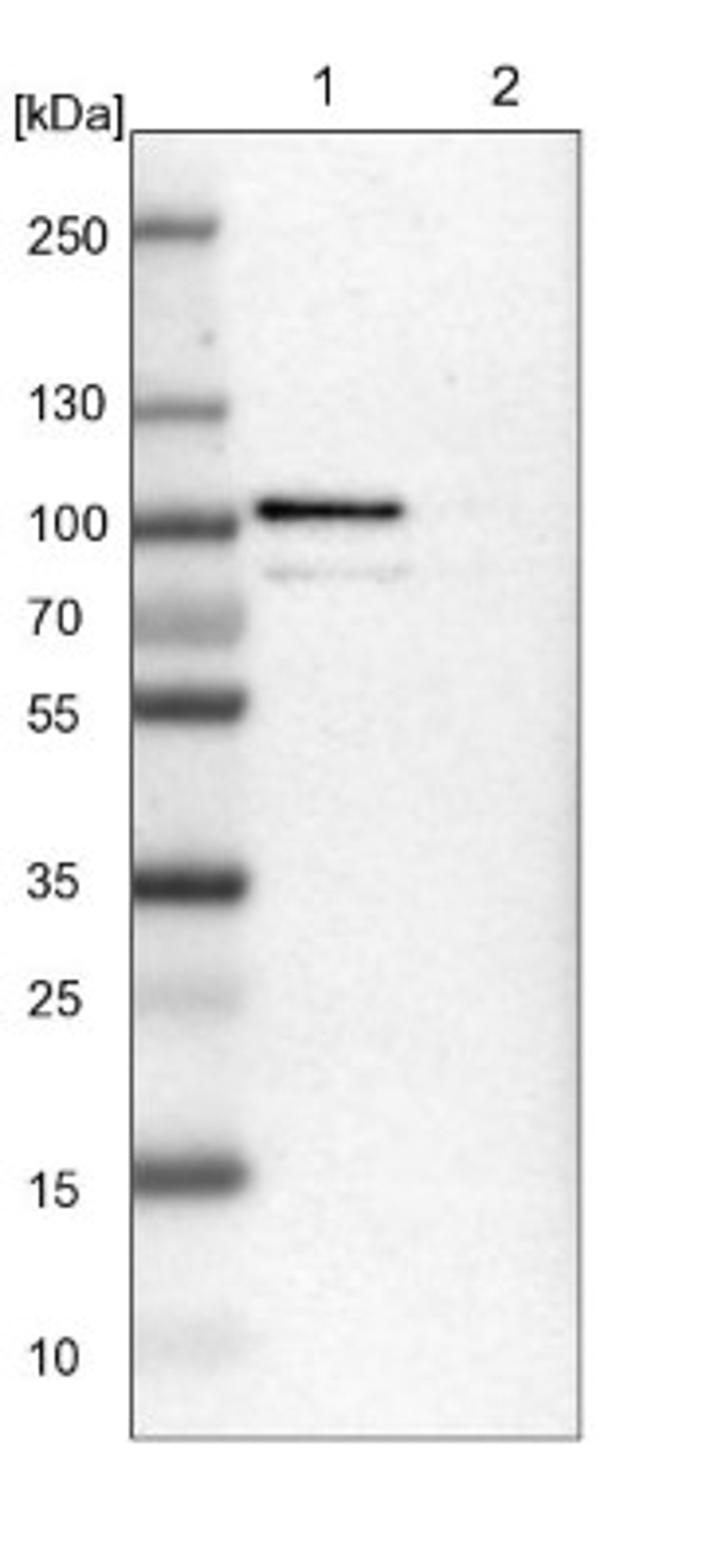 Western Blot: TTC14 Antibody [NBP1-84657] - Lane 1: NIH-3T3 cell lysate (Mouse embryonic fibroblast cells)<br/>Lane 2: NBT-II cell lysate (Rat Wistar bladder tumour cells)