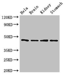 Western Blot. Positive WB detected in: Hela whole cell lysate, Mouse brain tissue, Mouse kidney tissue, Mouse stomach tissue. All lanes: NOB1 antibody at 1.5ug/ml. Secondary. Goat polyclonal to rabbit IgG at 1/50000 dilution. Predicted band size: 47 kDa. Observed band size: 47 kDa.