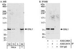 Detection of human GNL1 by western blot and immunoprecipitation.