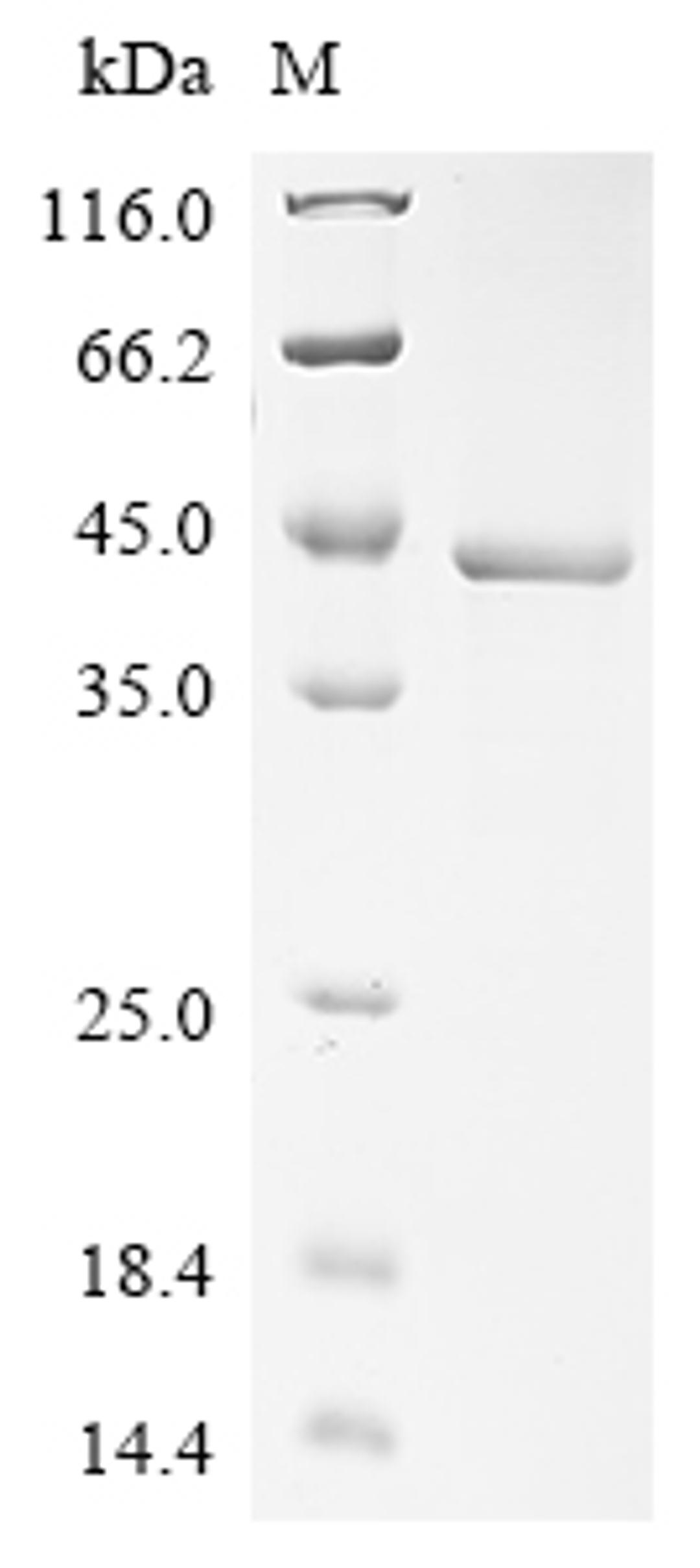 (Tris-Glycine gel) Discontinuous SDS-PAGE (reduced) with 5% enrichment gel and 15% separation gel.