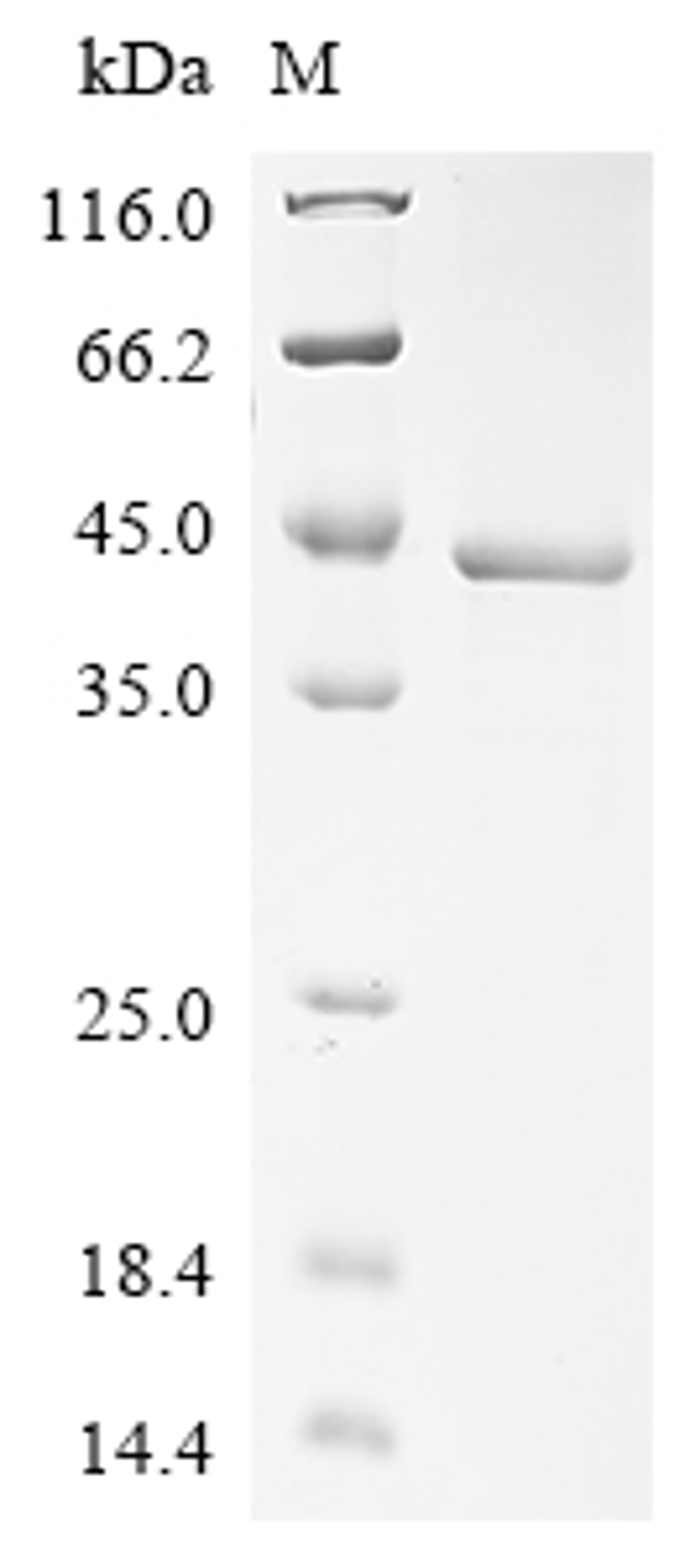 (Tris-Glycine gel) Discontinuous SDS-PAGE (reduced) with 5% enrichment gel and 15% separation gel.