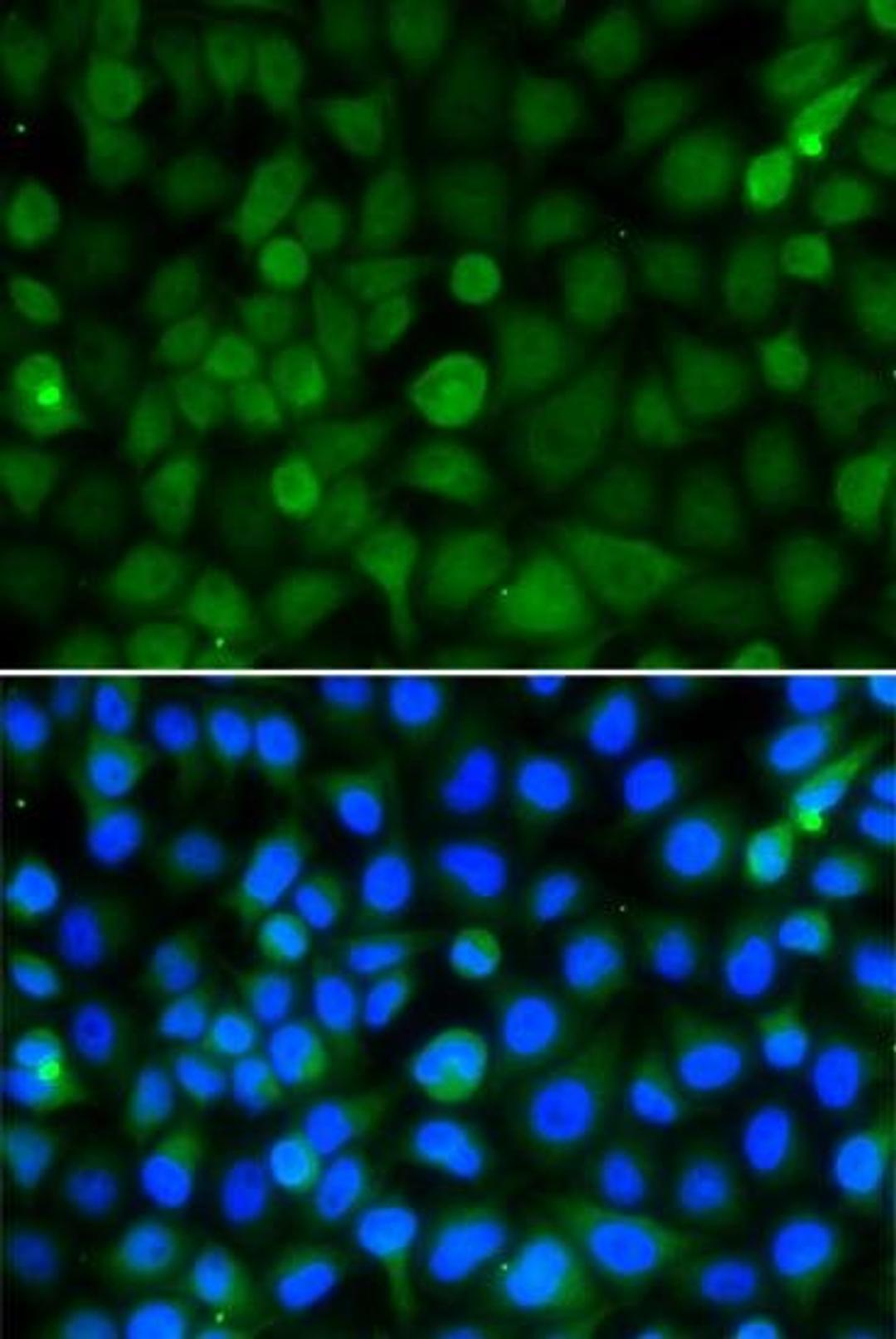 Immunofluorescence analysis of A549 cell using HIST2H4B antibody