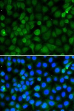 Immunofluorescence analysis of A549 cell using HIST2H4B antibody