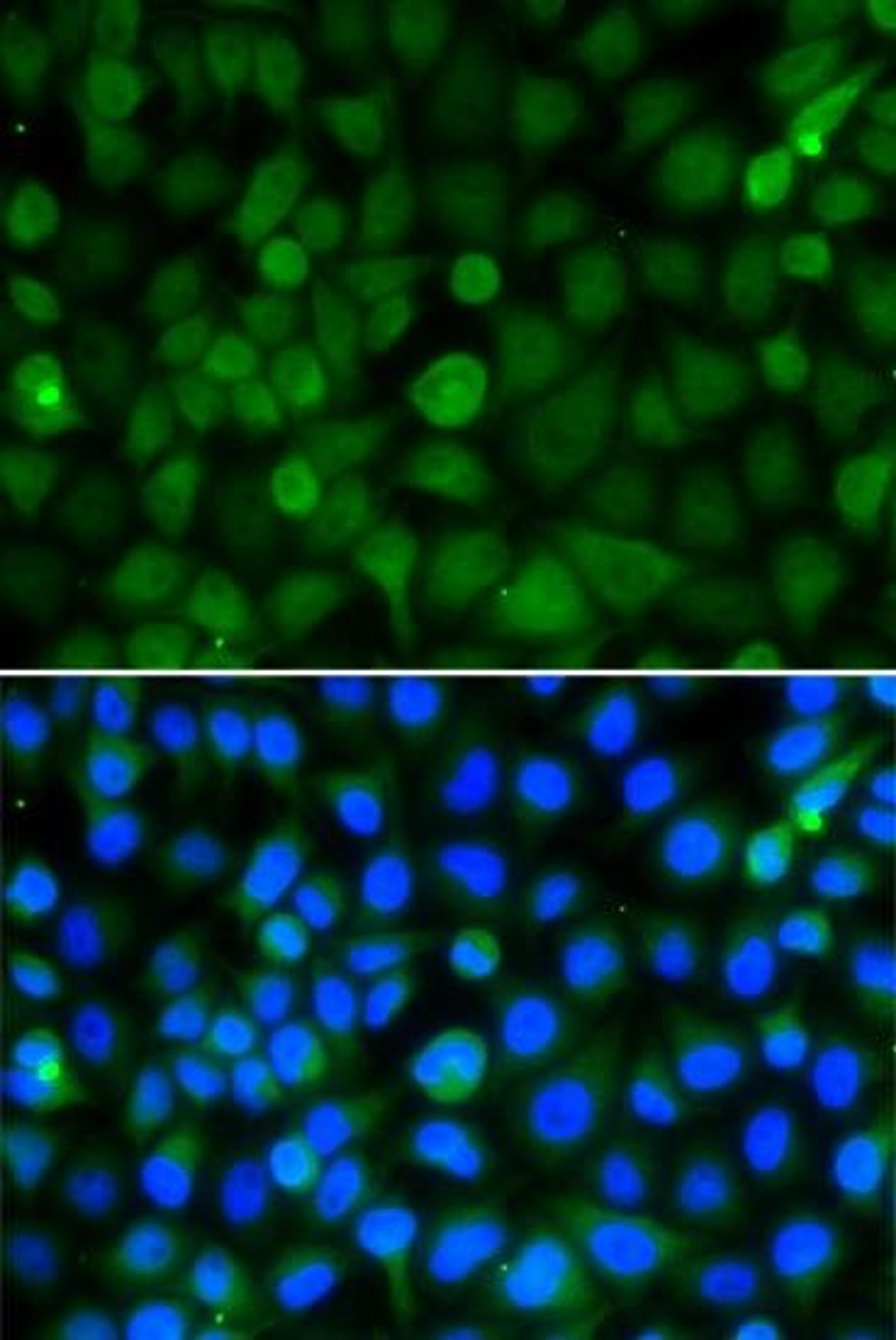 Immunofluorescence analysis of A549 cell using HIST2H4B antibody