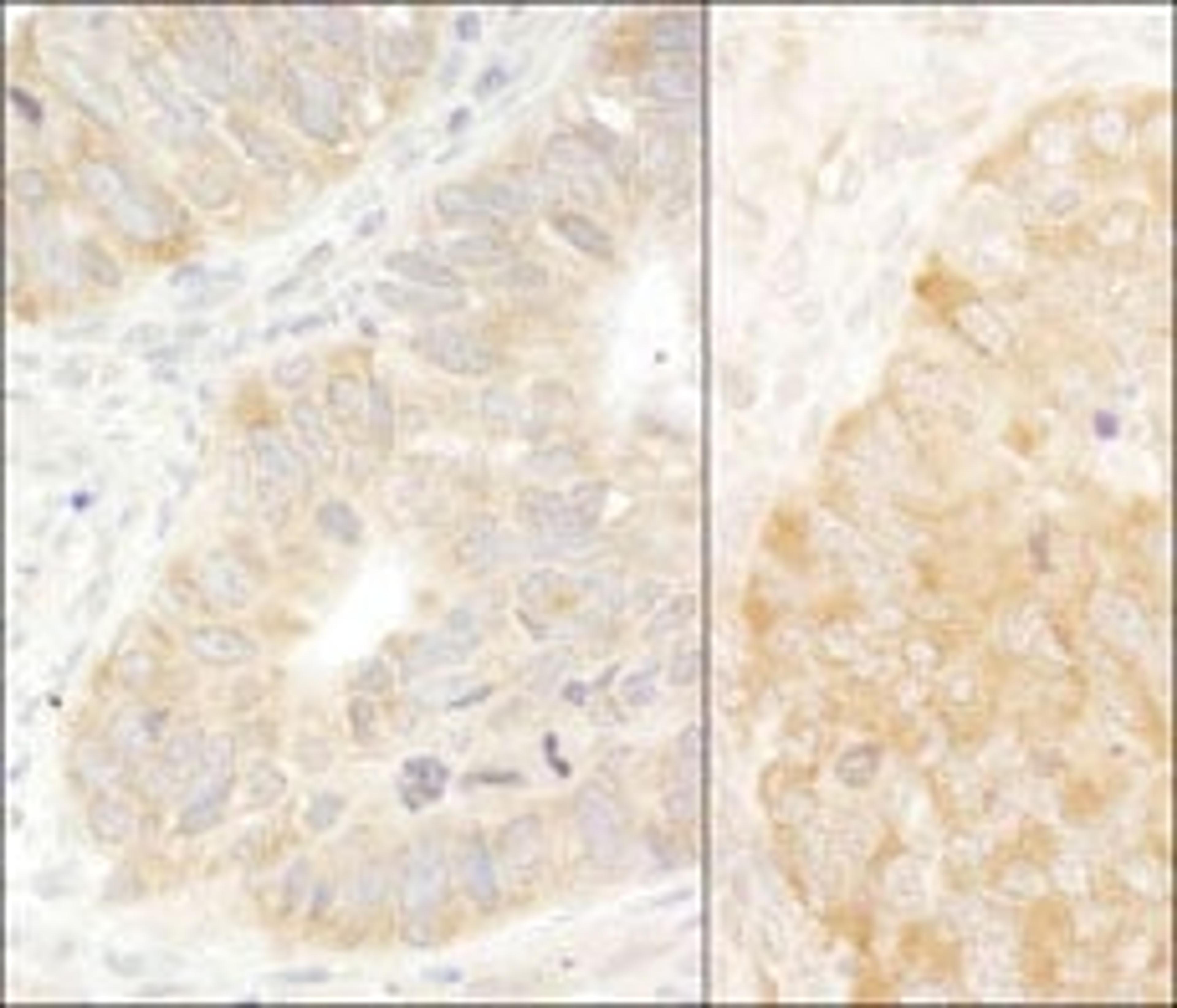 Detection of human and mouse eIF2alpha/EIF2S1 by immunohistochemistry.