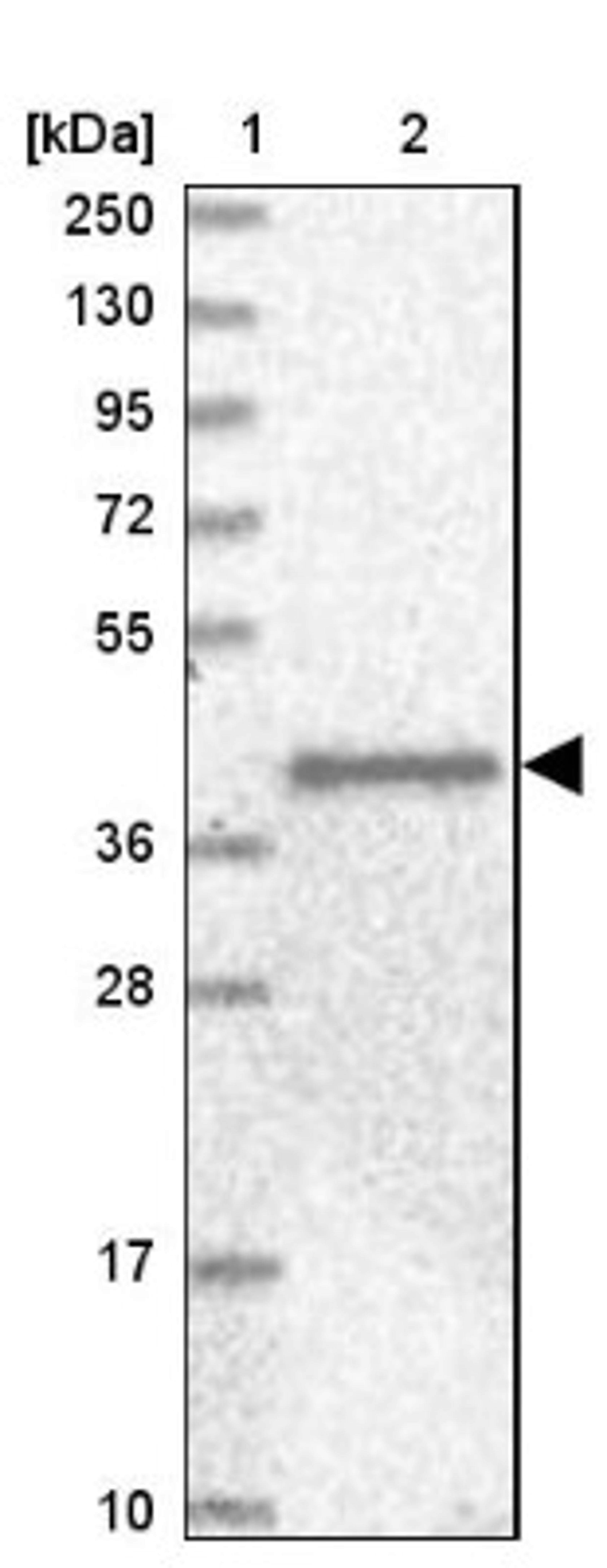 Western Blot: ANGPTL3 Antibody [NBP1-89087] - Lane 1: Marker [kDa] 250, 130, 95, 72, 55, 36, 28, 17, 10<br/>Lane 2: Human cell line RT-4