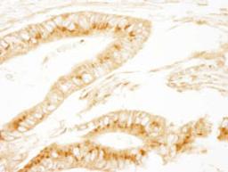 Detection of human PRKAR2A/PKA-RIIalpha by immunohistochemistry.