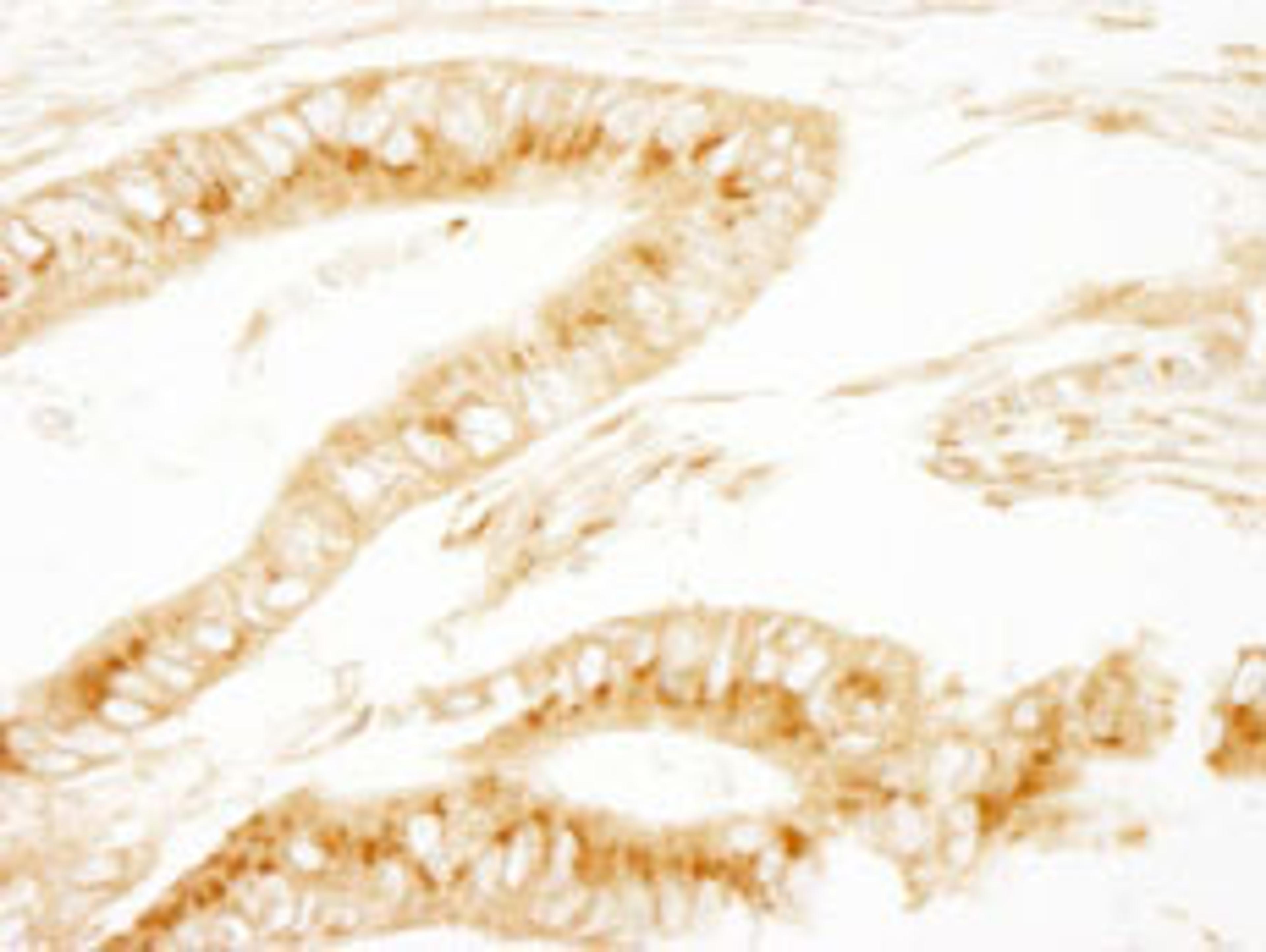 Detection of human PRKAR2A/PKA-RIIalpha by immunohistochemistry.