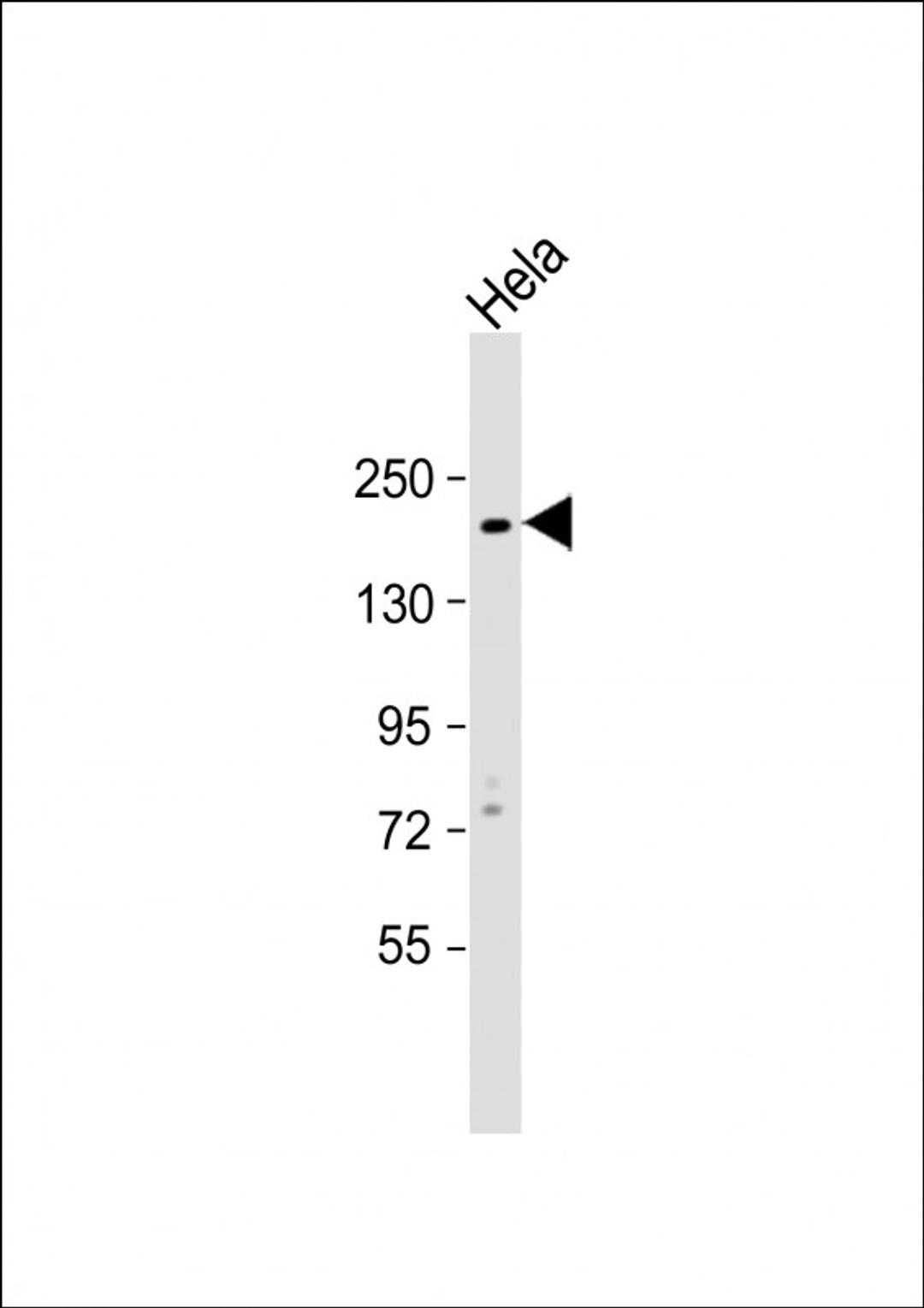 Western Blot at 1:1000 dilution + Hela whole cell lysate Lysates/proteins at 20 ug per lane.