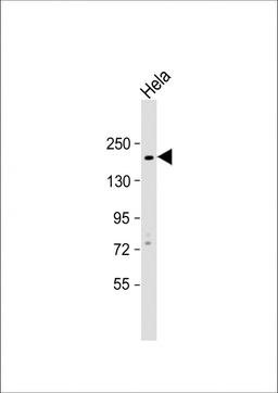 Western Blot at 1:1000 dilution + Hela whole cell lysate Lysates/proteins at 20 ug per lane.