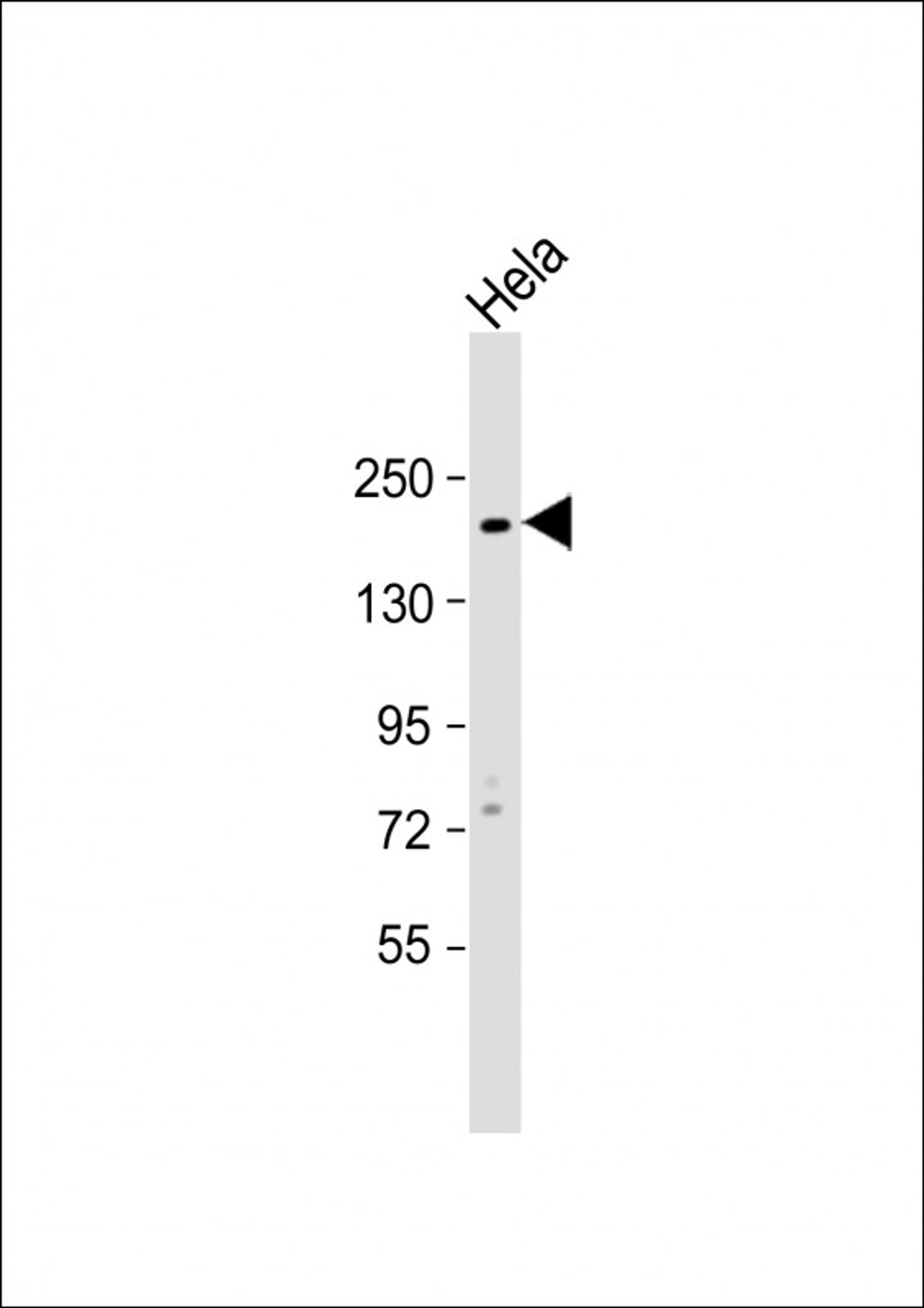 Western Blot at 1:1000 dilution + Hela whole cell lysate Lysates/proteins at 20 ug per lane.