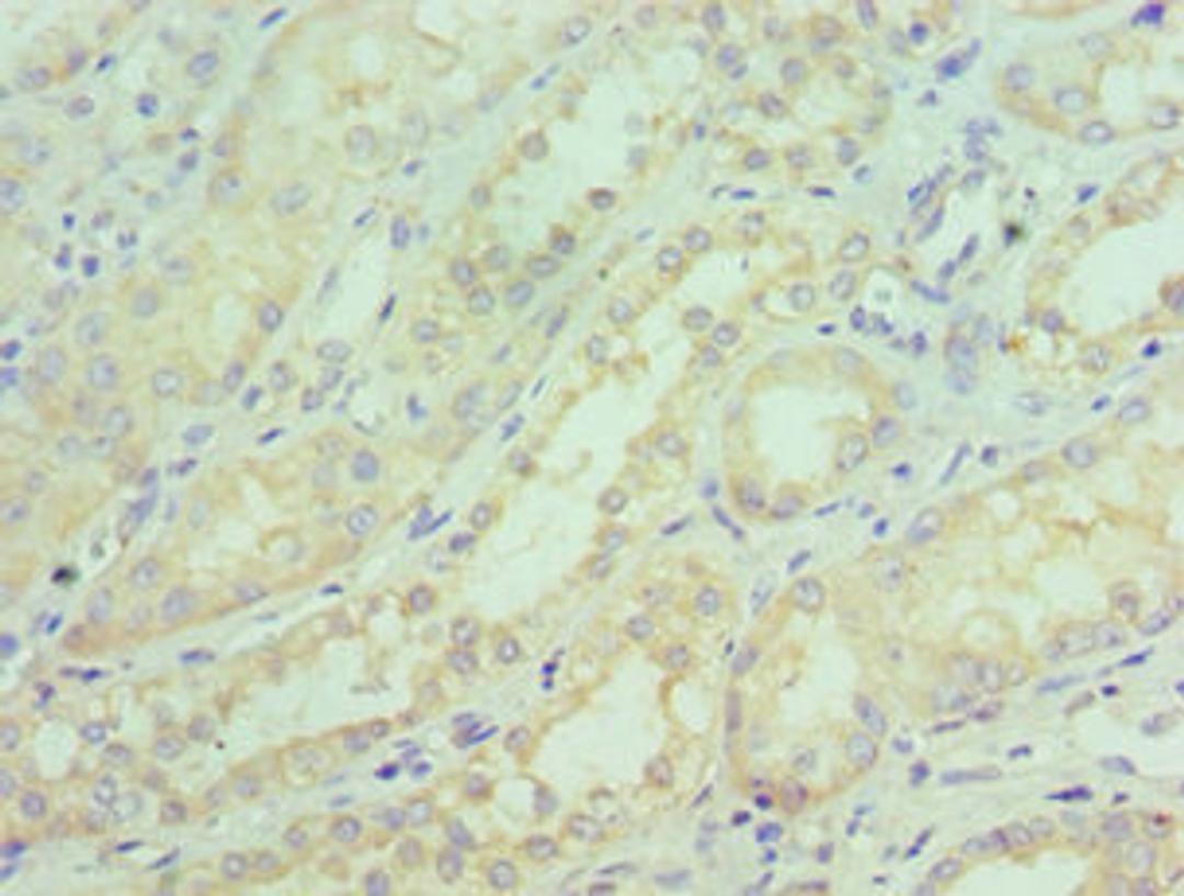 Immunohistochemistry of paraffin-embedded human kidney tissue using CSB-PA021204ESR2HU at dilution of 1:100