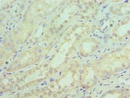Immunohistochemistry of paraffin-embedded human kidney tissue using CSB-PA021204ESR2HU at dilution of 1:100