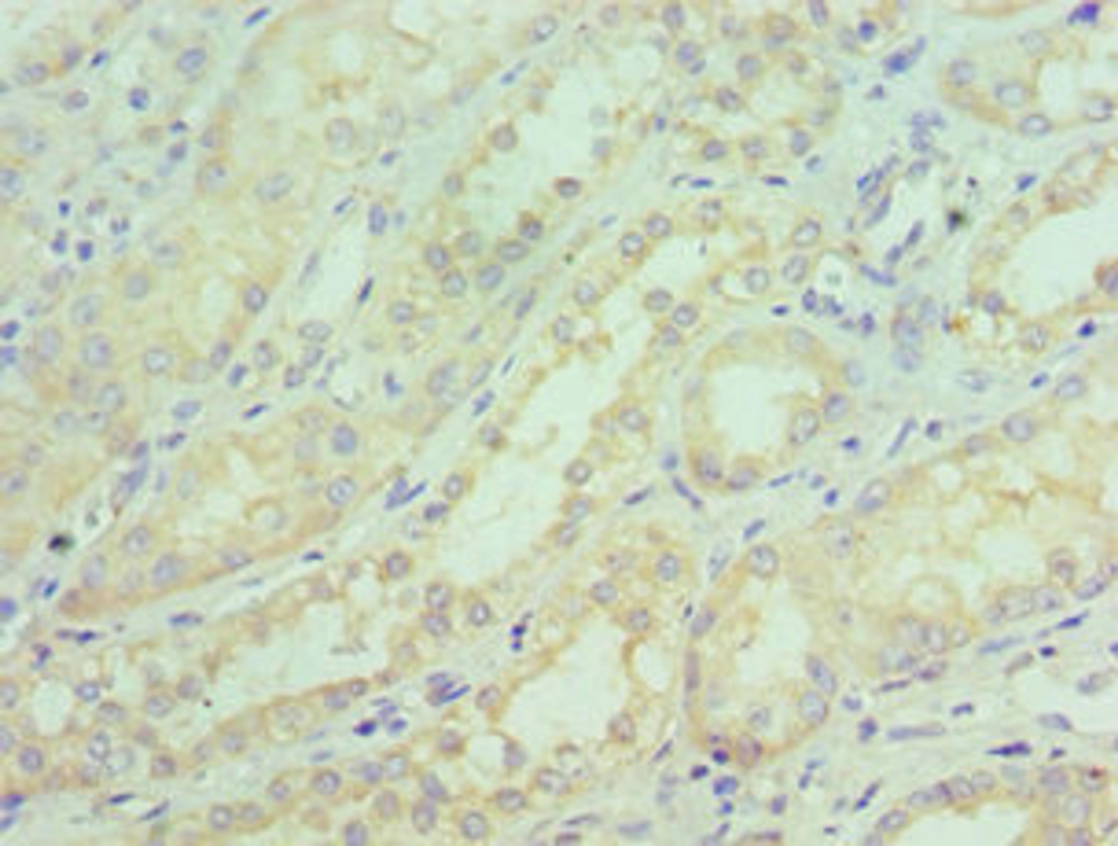 Immunohistochemistry of paraffin-embedded human kidney tissue using CSB-PA021204ESR2HU at dilution of 1:100