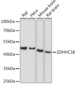 Western blot - ZDHHC18 Rabbit pAb (A15199)