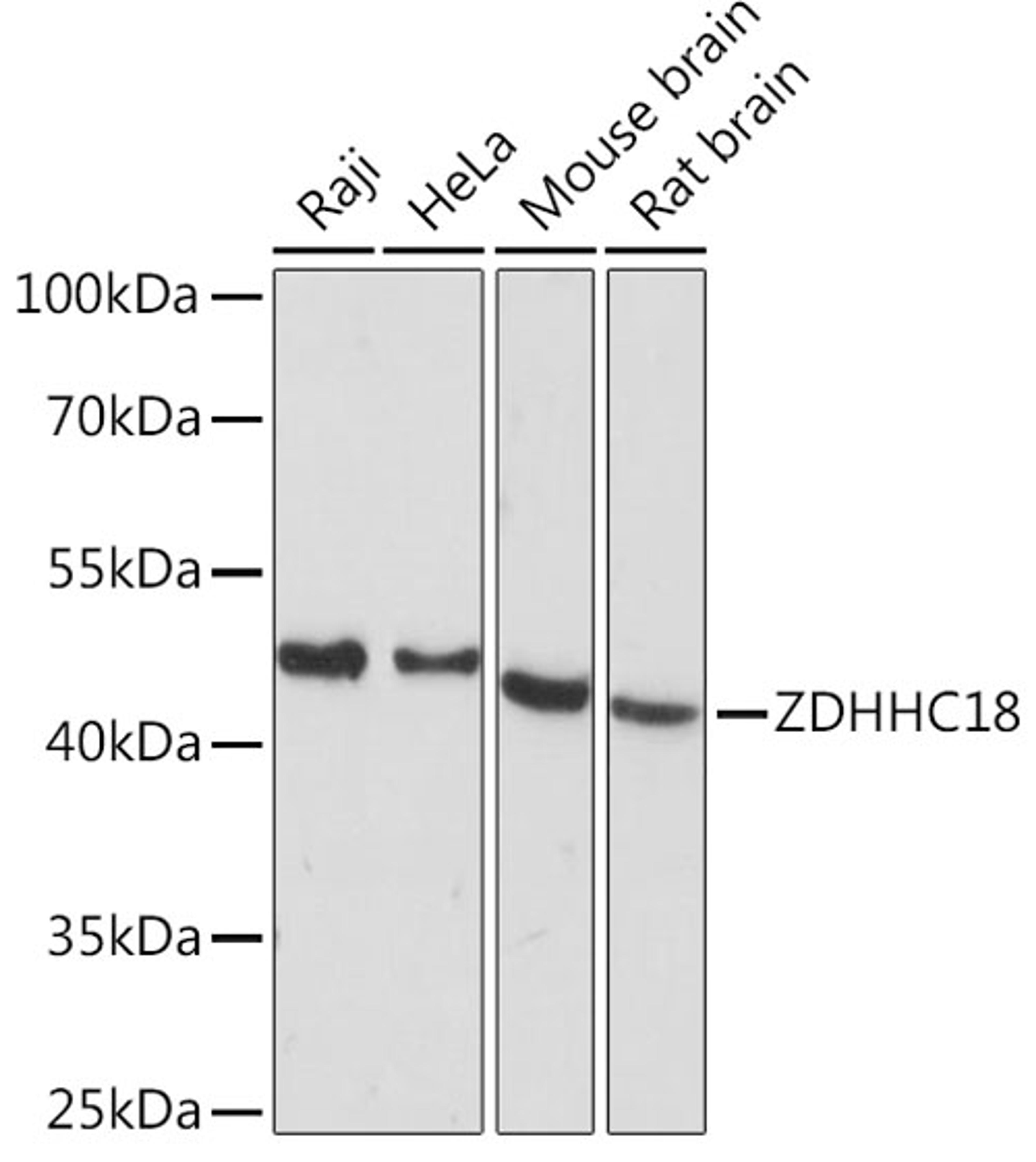 Western blot - ZDHHC18 Rabbit pAb (A15199)