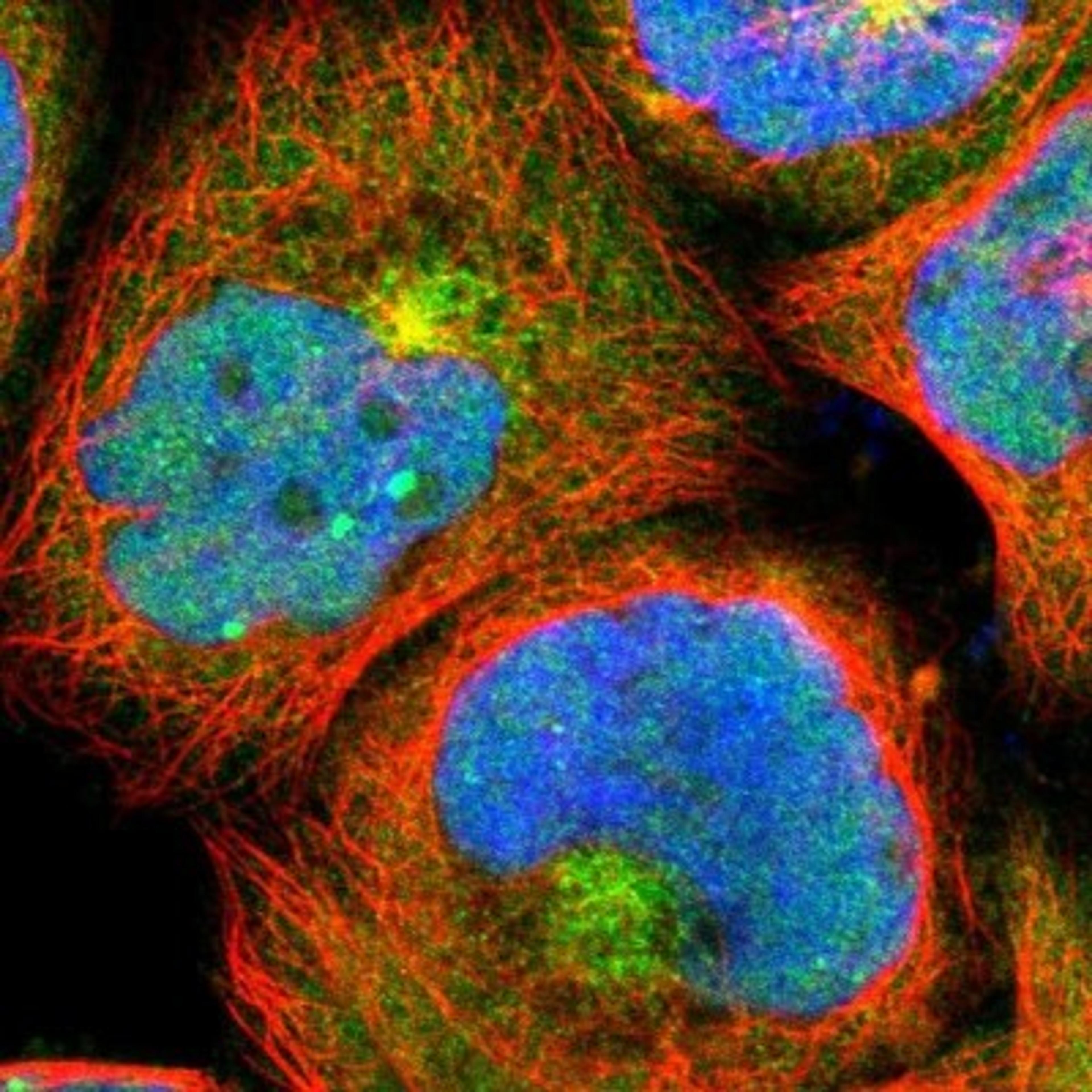 Immunocytochemistry/Immunofluorescence: Syntaxin 3 Antibody [NBP1-86984] - Immunofluorescent staining of human cell line A-431 shows positivity in nucleus, cytoplasm & golgi apparatus.