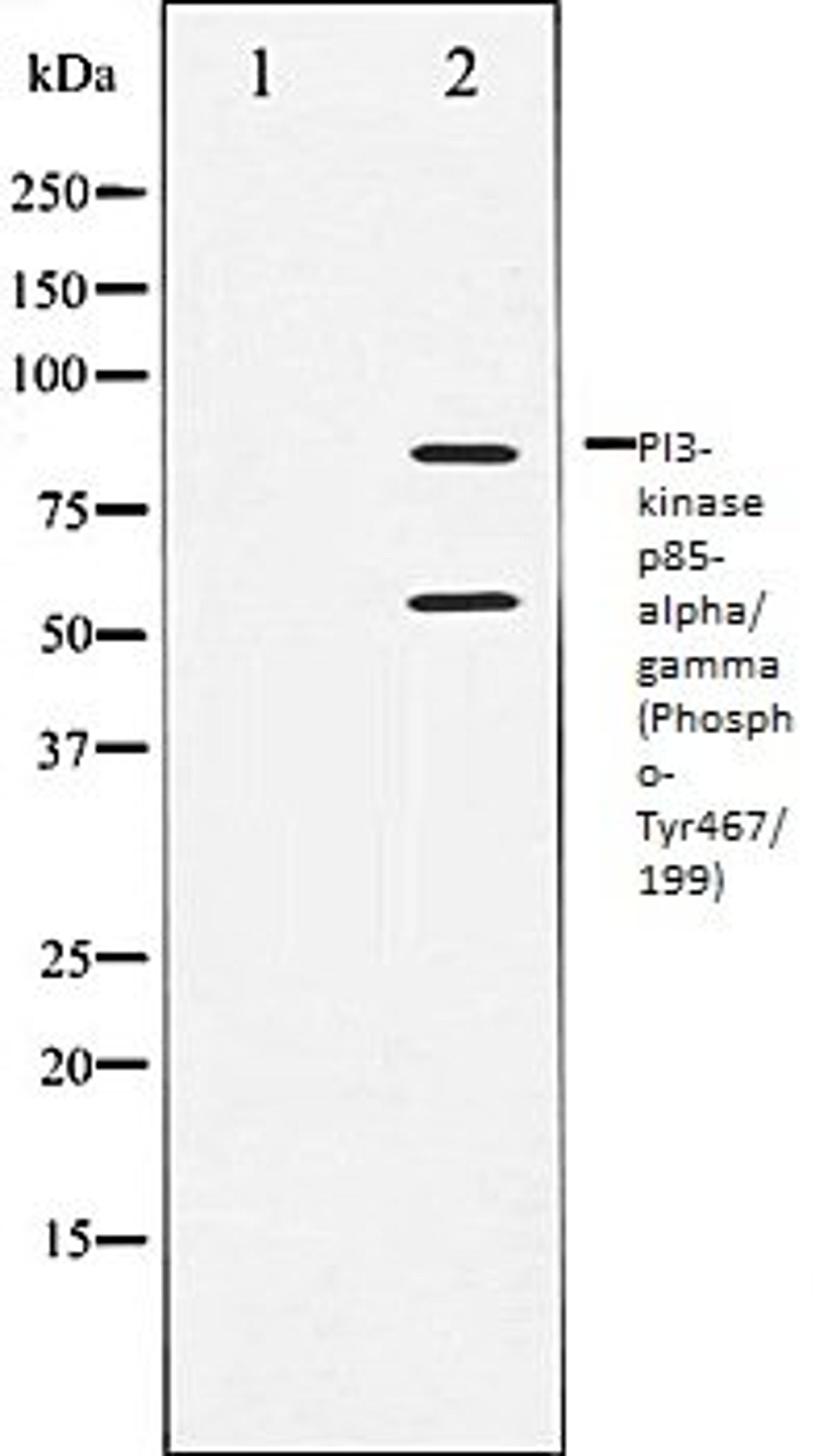 Western blot analysis of COS7 whole cell lysates using PI3-kinase p85- alpha/ gamma (Phospho-Tyr467/199) antibody, The lane on the left is treated with the antigen-specific peptide.