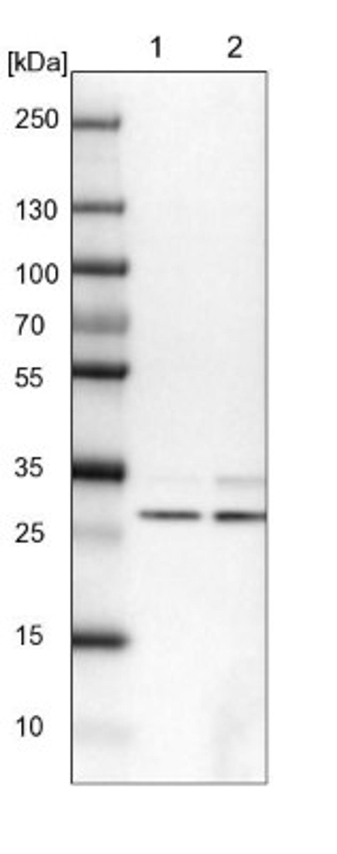 Western Blot: FTS Antibody [NBP2-14279] - Lane 1: NIH-3T3 cell lysate (Mouse embryonic fibroblast cells)<br/>Lane 2: NBT-II cell lysate (Rat Wistar bladder tumour cells)